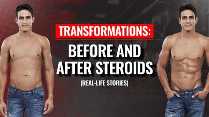 Transformations Unveiled: The Impact of Roids Before and After